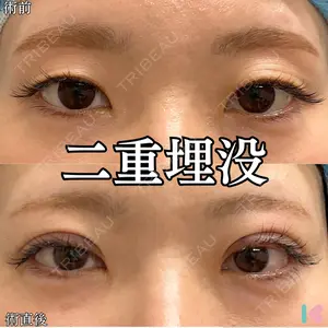 形成外科と美容外科のクリニック池袋 春日 航医師の症例