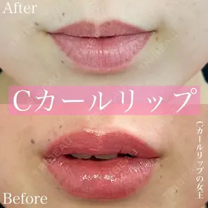 ルラ美容クリニック 渋谷本院 昼間 路子医師の症例