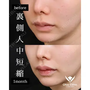 Otus Clinic 【オータスクリニック】 中 徳太郎医師の症例