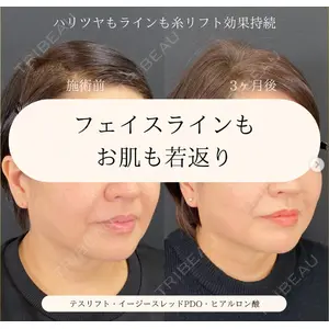 自由が丘ウェルエイジングビューティークリニックの症例