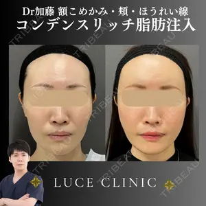 ルーチェクリニック 銀座院 加藤晴之輔医師の症例