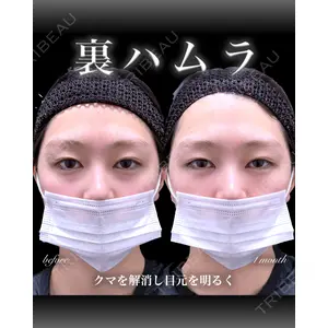 EMMO FACE CLINIC 大宮院 百瀬 直也医師の症例