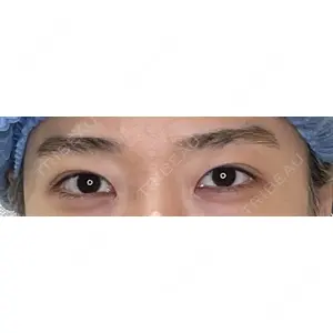 APOLLO BEAUTY CLINIC 鬼沢 正道医師の症例