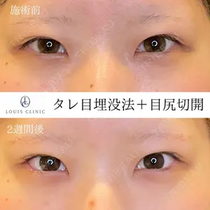 LOUIS CLINIC 二子玉川院【ルイクリニック】 小松 塁医師の症例