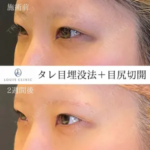 LOUIS CLINIC 二子玉川院【ルイクリニック】 小松 塁医師の症例