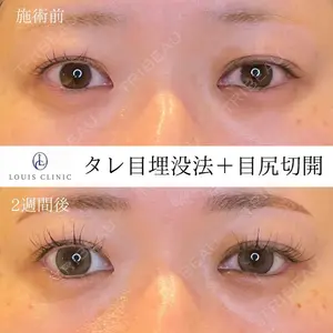 LOUIS CLINIC 二子玉川院【ルイクリニック】 小松 塁医師の症例