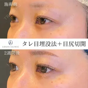 LOUIS CLINIC 二子玉川院【ルイクリニック】 小松 塁医師の症例