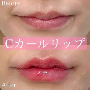 ルラ美容クリニック 渋谷本院 昼間 路子医師の症例