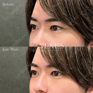 NEXUS CLINIC 横田 智子医師の症例
