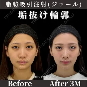 EMMO FACE CLINIC 東京三田院 木之下 哲彦医師の症例