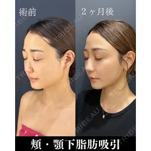 HAAB×DREAM BEAUTY CLINIC 東京本院 吉岡 修一医師の症例