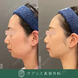 オアシス美容外科 遠藤 剛史医師の症例