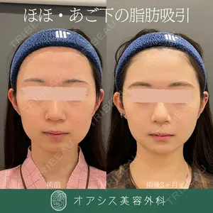 オアシス美容外科 遠藤 剛史医師の症例