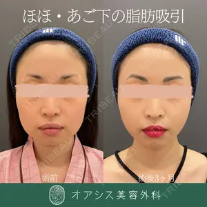 オアシス美容外科 遠藤 剛史医師の症例