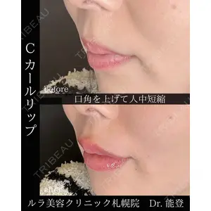 ルラ美容クリニック 札幌院 能登 貴弘医師の症例