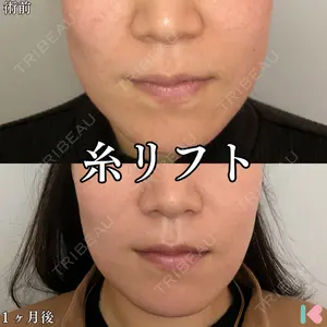 形成外科と美容外科のクリニック池袋 春日 航医師の症例