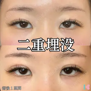 形成外科と美容外科のクリニック池袋 春日 航医師の症例