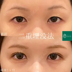オアシス美容外科 遠藤 剛史医師の症例