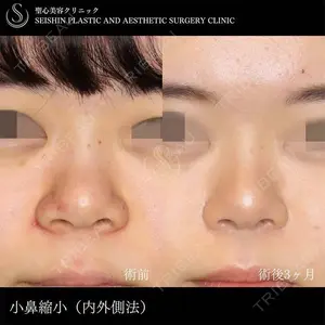 聖心美容クリニック 札幌院の症例