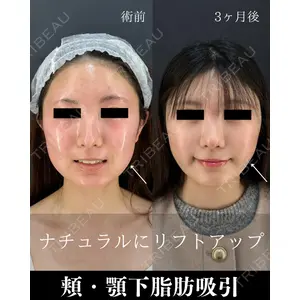 HAAB×DREAM BEAUTY CLINIC 東京本院 吉岡 修一医師の症例