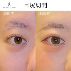 LOUIS CLINIC 二子玉川院【ルイクリニック】 小松 塁医師の症例