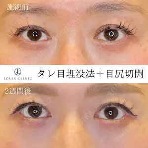 LOUIS CLINIC 二子玉川院【ルイクリニック】 小松 塁医師の症例