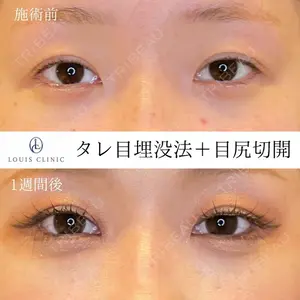 LOUIS CLINIC 二子玉川院【ルイクリニック】 小松 塁医師の症例
