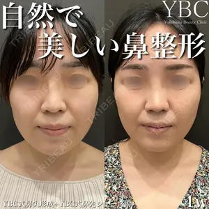 YBC横浜美容外科 大宮院 磯村 亮輔医師の症例