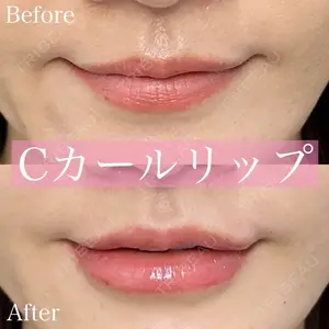 ルラ美容クリニック 渋谷本院 昼間 路子医師の症例