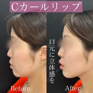 ルラ美容クリニック 渋谷本院 昼間 路子医師の症例