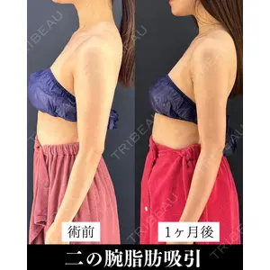 HAAB×DREAM BEAUTY CLINIC 東京本院 吉岡 修一医師の症例