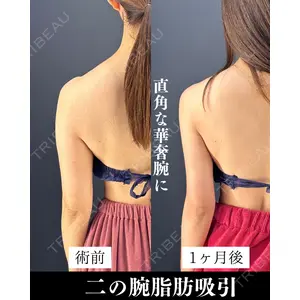 HAAB×DREAM BEAUTY CLINIC 東京本院 吉岡 修一医師の症例