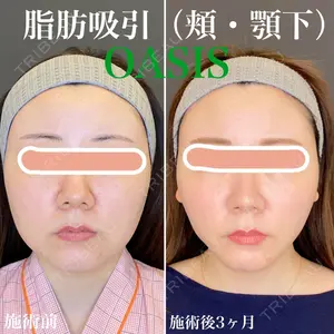 オアシス美容外科 遠藤 剛史医師の症例