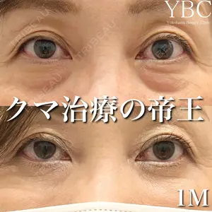 YBC横浜美容外科 大宮院 磯村 亮輔医師の症例