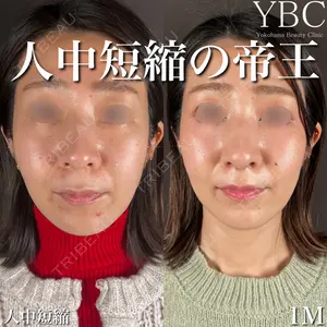 YBC横浜美容外科 大宮院 磯村 亮輔医師の症例