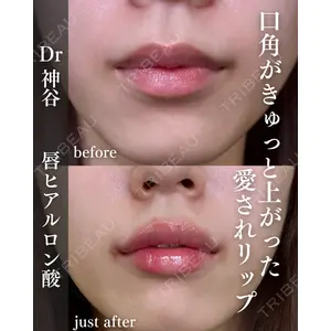 EMMO FACE CLINIC 大阪梅田院 神谷 一成医師の症例