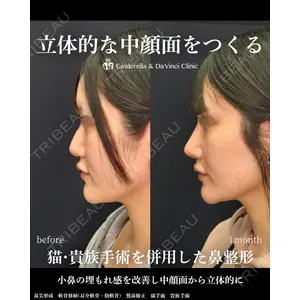 シンデレラ＆ダヴィンチクリニック 宮田 洋佑医師の症例