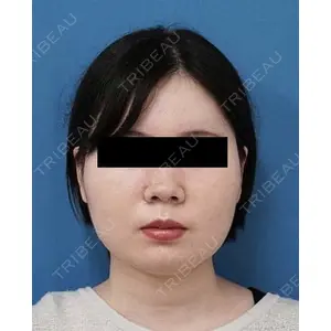 もとび美容外科クリニック 新宿院 西尾 謙三郎医師の症例