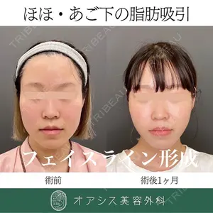 オアシス美容外科 遠藤 剛史医師の症例