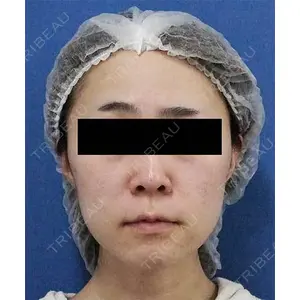 もとび美容外科クリニック 新宿院 西尾 謙三郎医師の症例