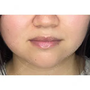 はやし歯科ほんまち院の症例