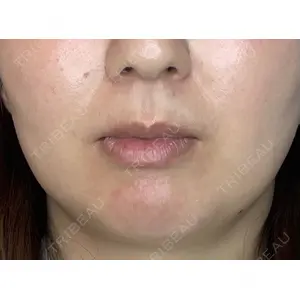 はやし歯科ほんまち院の症例