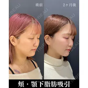 HAAB×DREAM BEAUTY CLINIC 東京本院 吉岡 修一医師の症例