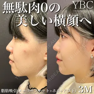 YBC横浜美容外科 立川院の症例