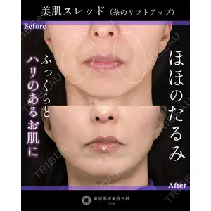 東京形成美容外科 銀座院 中尾 真紀医師の症例