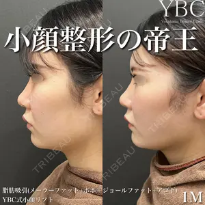 YBC横浜美容外科 大宮院 磯村 亮輔医師の症例
