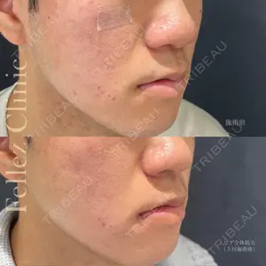 Fellez Clinic【フェルズクリニック】の症例