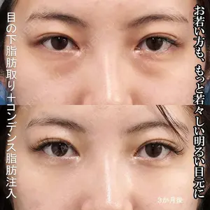 もとび美容外科クリニック 新宿院 西尾 謙三郎医師の症例