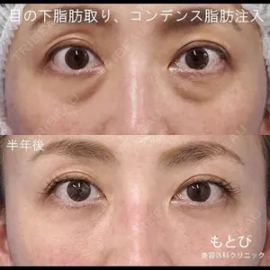 もとび美容外科クリニック 新宿院 西尾 謙三郎医師の症例