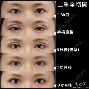 もとび美容外科クリニック 新宿院 西尾 謙三郎医師の症例
